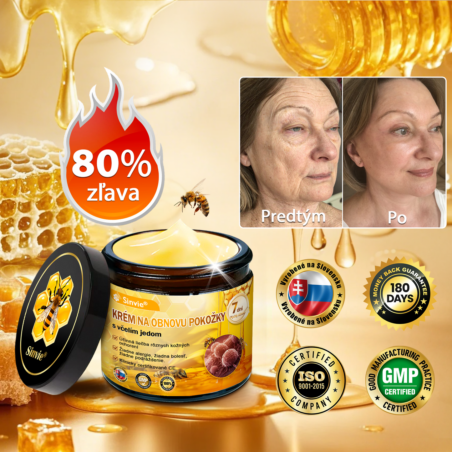 🧑‍⚕️Sinvie® Krém na obnovu pokožky s včelím jedom 🐝 Odporúčané dermatológmi | Proti vráskam, pigmentovým škvrnám a ochabnutej pokožke – 50 ml