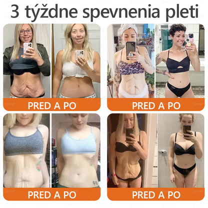 ✨Sinvie® Krém na obnovu pokožky s včelím jedom 🔥 Odporúčané dermatológmi | Proti vráskam, pigmentovým škvrnám a ochabnutej pokožke – 50 ml