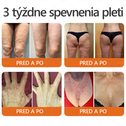 ✨Sinvie® Krém na obnovu pokožky s včelím jedom 🔥 Odporúčané dermatológmi | Proti vráskam, pigmentovým škvrnám a ochabnutej pokožke – 50 ml