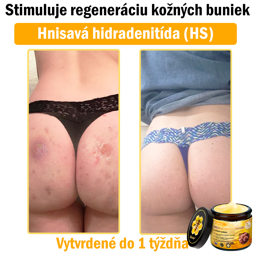 🐝 Sinvie® včelím jedom obnovu pokožky Krém (👨‍⚕‍CE schválené)👍✅