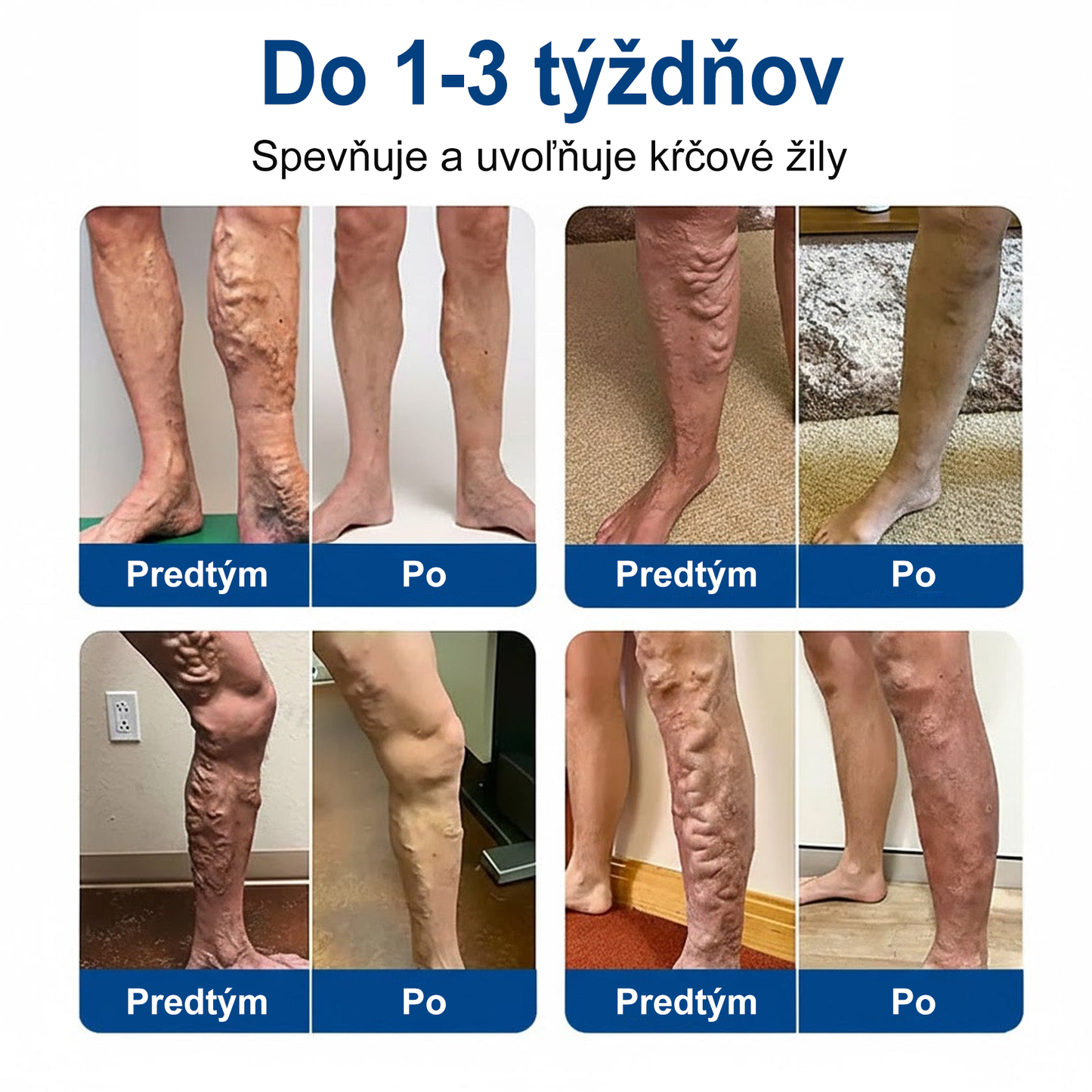 🔥Medistart® VeinRepair – mikrotűs ápoló tapasz ⚡ Azonnali megkönnyebbülés, hosszan tartó eredmény