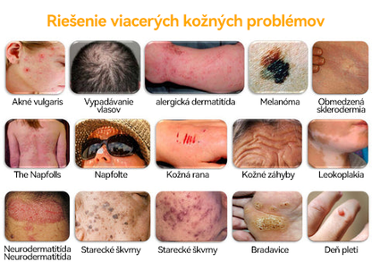🐝 Sinvie® včelím jedom obnovu pokožky Krém (👨‍⚕‍CE schválené)👍✅