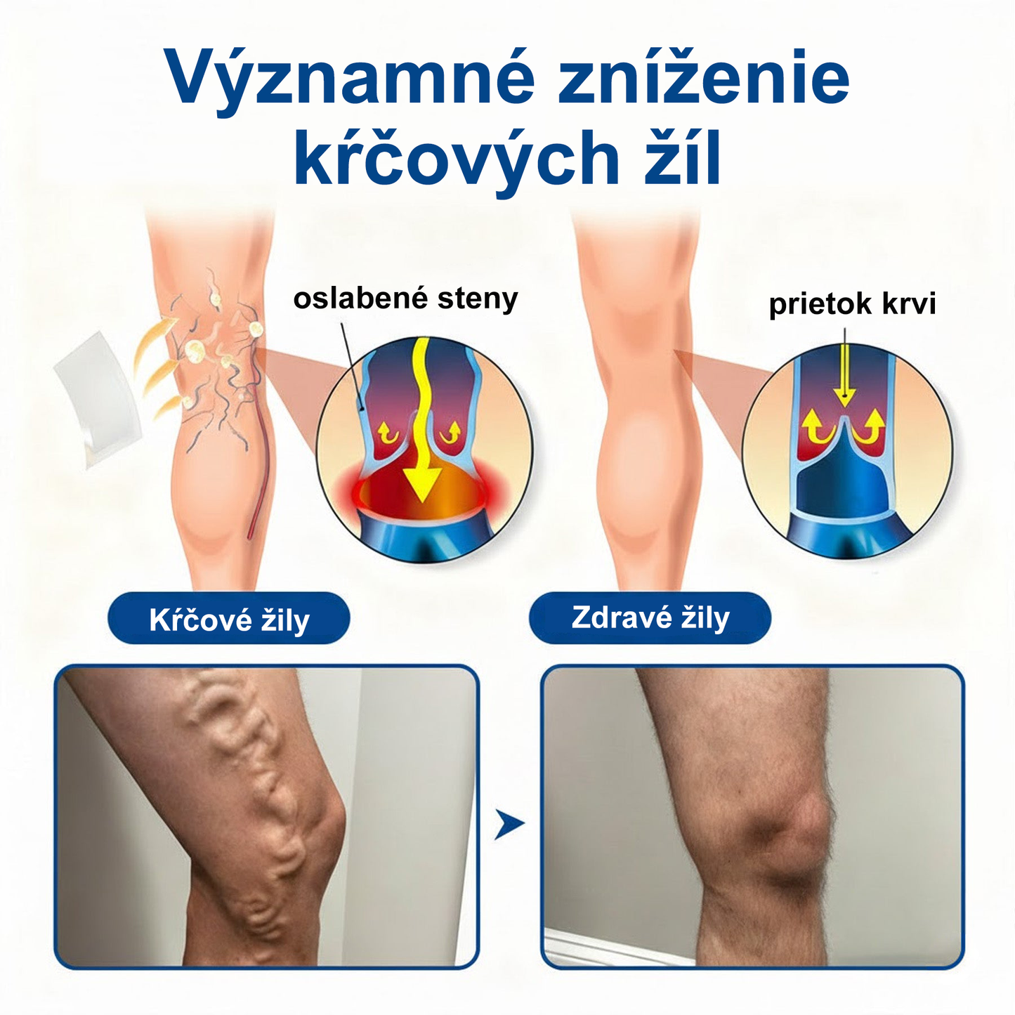 🔥Medistart® VeinRepair – mikrotűs ápoló tapasz ⚡ Azonnali megkönnyebbülés, hosszan tartó eredmény
