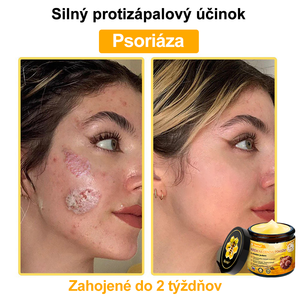 🐝 Sinvie® včelím jedom obnovu pokožky Krém (👨‍⚕‍Výroba v súlade s normami GMP)👍✅