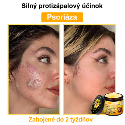 🐝 Sinvie® včelím jedom obnovu pokožky Krém (👨‍⚕‍Výroba v súlade s normami GMP)👍✅
