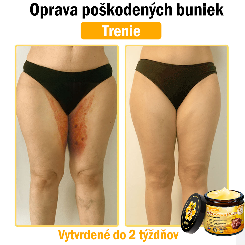 🐝 Sinvie® včelím jedom obnovu pokožky Krém (👨‍⚕‍Výroba v súlade s normami GMP)👍✅