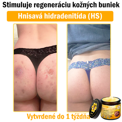 🐝 Sinvie® včelím jedom obnovu pokožky Krém (👨‍⚕‍Výroba v súlade s normami GMP)👍✅