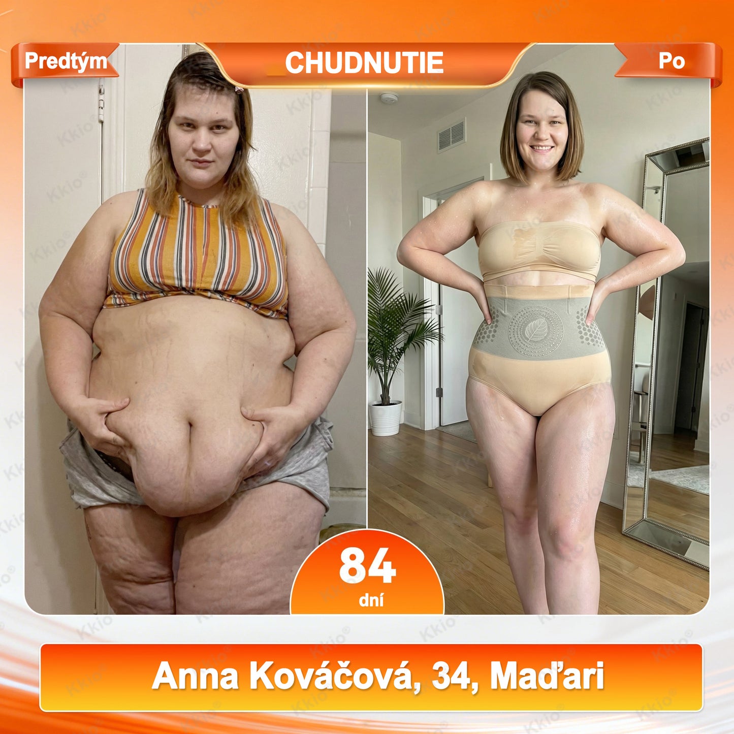 🔥 Objavte tajomstvo – Kkio® 4 v 1 tvarovacie a spaľovačské kraťasy s mikronizovanou moringou a borberínom ☘️ Výhradne v oficiálnom e-shope značky.
