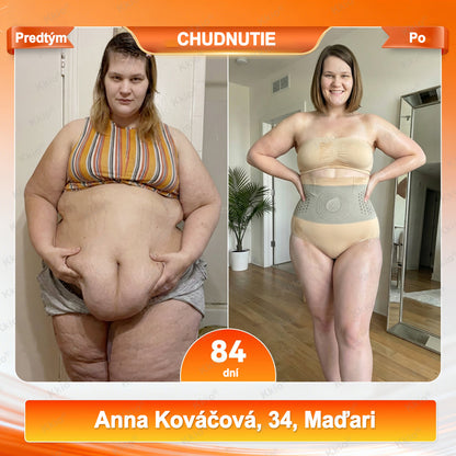 🔥 Objavte tajomstvo – Kkio® 4 v 1 tvarovacie a spaľovačské kraťasy s mikronizovanou moringou a borberínom ☘️ Výhradne v oficiálnom e-shope značky.