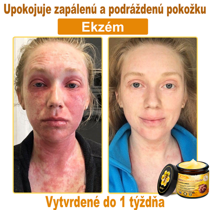🐝 Sinvie® včelím jedom obnovu pokožky Krém (👨‍⚕‍Výroba v súlade s normami GMP)👍✅