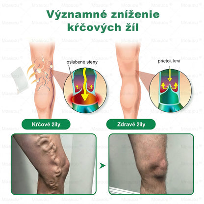 👨‍⚕️✅Moauou® Cieľová Mikronedlová Náplasť na žily⚡Okamžitá úľava, dlhodobé výsledky – veľký výpredaj