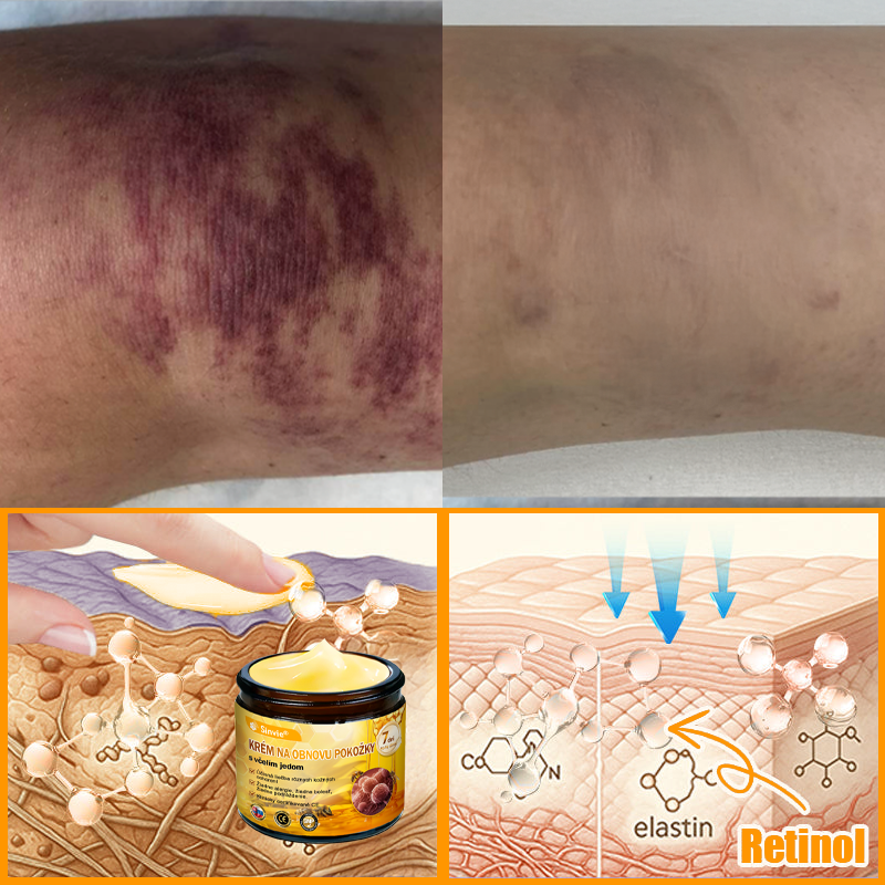 🐝 Sinvie® včelím jedom obnovu pokožky Krém (👨‍⚕‍CE schválené)👍✅