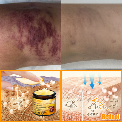 🐝 Sinvie® včelím jedom obnovu pokožky Krém (👨‍⚕‍CE schválené)👍✅