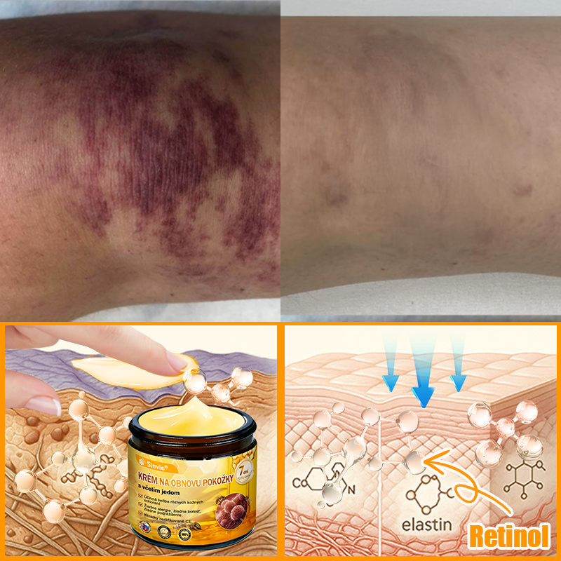 🐝 Sinvie® včelím jedom obnovu pokožky Krém (👨‍⚕‍Výroba v súlade s normami GMP)👍✅