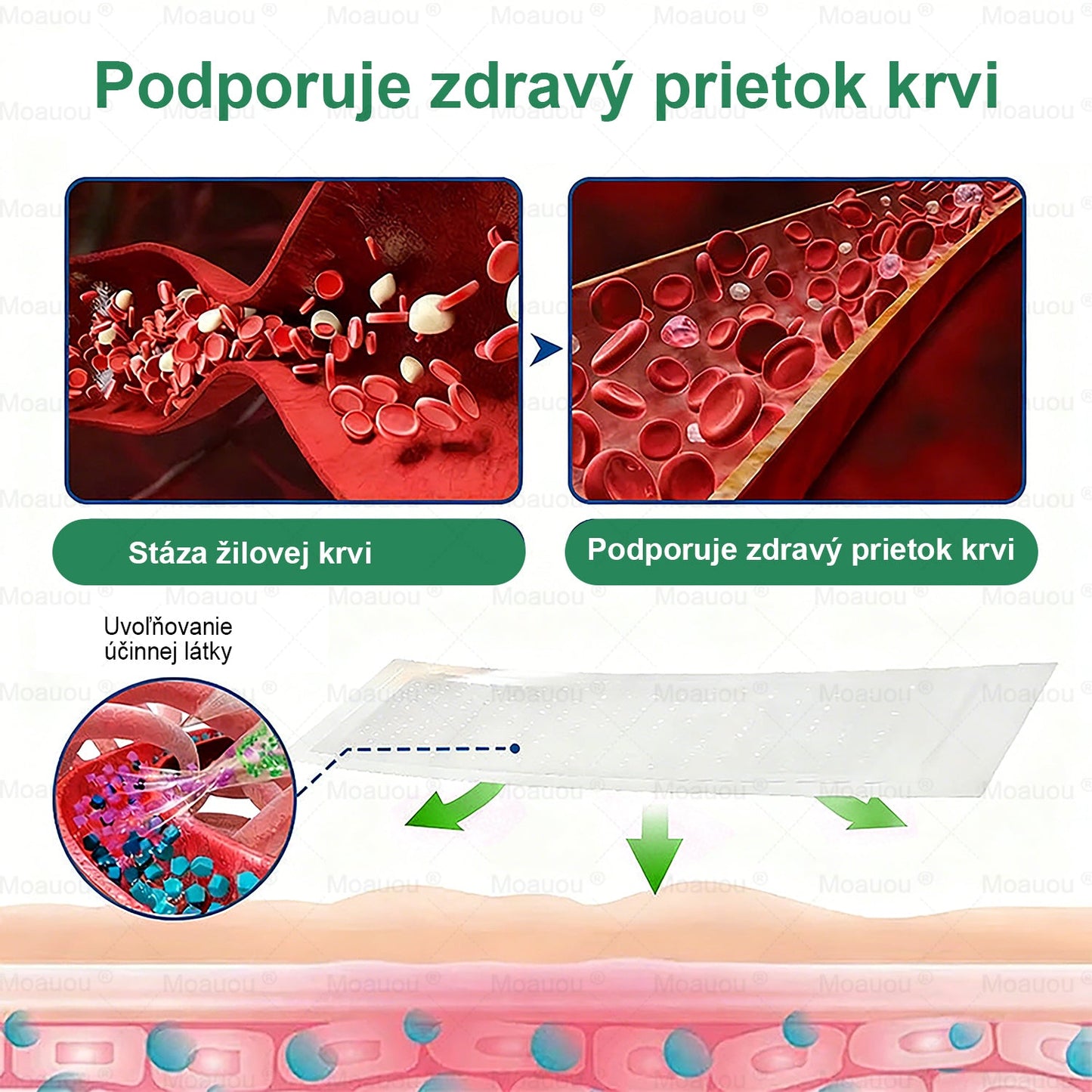 👨‍⚕️✅Moauou® Cieľová Mikronedlová Náplasť na žily⚡Okamžitá úľava, dlhodobé výsledky – veľký výpredaj
