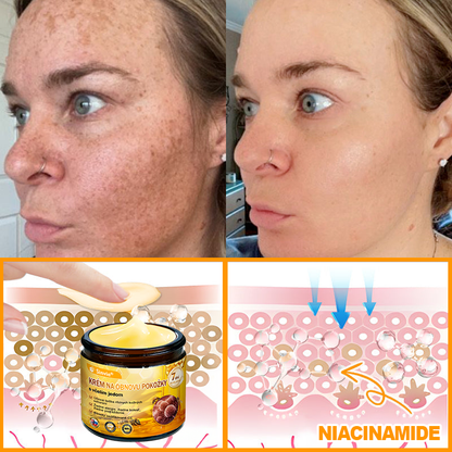 🐝 Sinvie® včelím jedom obnovu pokožky Krém (👨‍⚕‍Výroba v súlade s normami GMP)👍✅