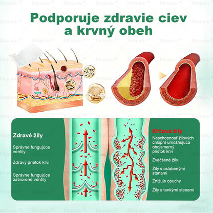 👨‍⚕️✅Moauou® Cieľová Mikronedlová Náplasť na žily⚡Okamžitá úľava, dlhodobé výsledky – veľký výpredaj